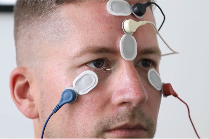 figure 5 ovemp electrode montage